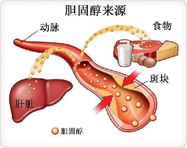 膽固醇飲食多普勒廠家.jpg